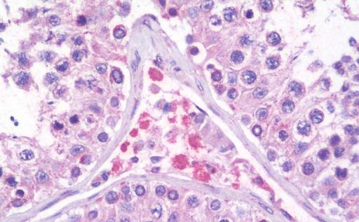 Immunohistochemistry (Formalin/PFA-fixed paraffin-embedded sections) - Anti-Prickle 2 antibody (AB211419)