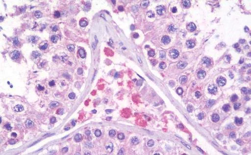 Immunohistochemistry (Formalin/PFA-fixed paraffin-embedded sections) - Anti-Prickle 2 antibody (AB211419)