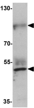 Western blot - Anti-Prickle 2 antibody (AB211419)
