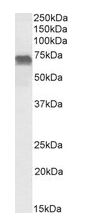 Western blot - Anti-PRICKLE3 antibody (AB183522), expandable thumbnail