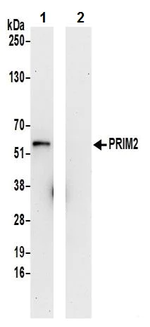 Immunoprecipitation - Anti-PRIM2 antibody (AB241990)