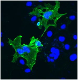 Immunocytochemistry/ Immunofluorescence - Anti-Prion protein PrP antibody (AB178545), expandable thumbnail