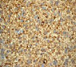 Immunohistochemistry (Formalin/PFA-fixed paraffin-embedded sections) - Anti-Prion protein PrP antibody [EP1802Y] (ab52604), expandable thumbnail
