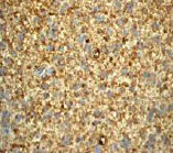 Immunohistochemistry (Formalin/PFA-fixed paraffin-embedded sections) - Anti-Prion protein PrP antibody [EP1802Y] (AB52604)