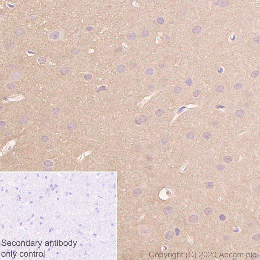 Immunohistochemistry (Formalin/PFA-fixed paraffin-embedded sections) - Anti-Prion protein PrP antibody [EP1802Y] (AB52604), expandable thumbnail