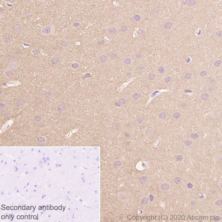 Immunohistochemistry (Formalin/PFA-fixed paraffin-embedded sections) - Anti-Prion protein PrP antibody [EP1802Y] (AB52604)
