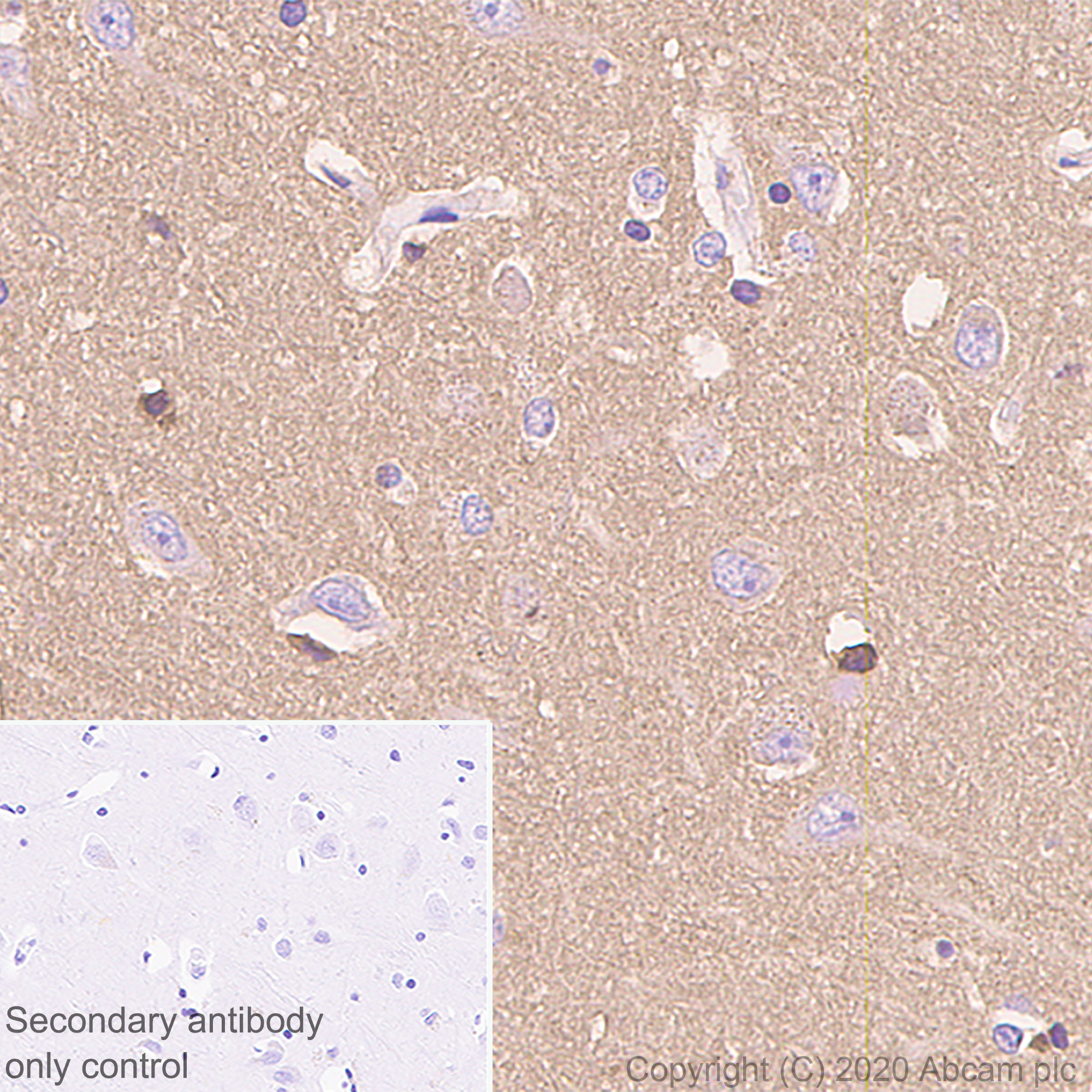 Immunohistochemistry (Formalin/PFA-fixed paraffin-embedded sections) - Anti-Prion protein PrP antibody [EP1802Y] (AB52604), expandable thumbnail
