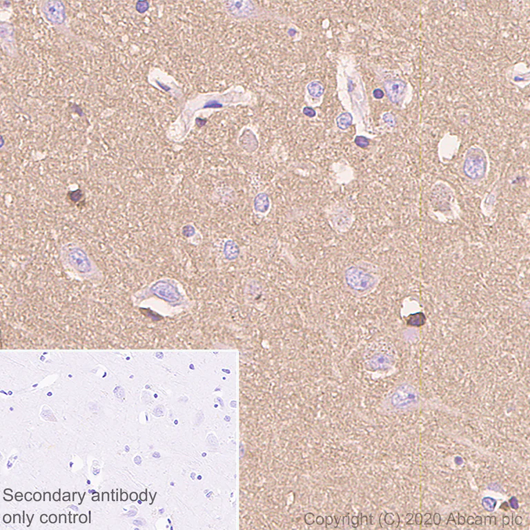 Immunohistochemistry (Formalin/PFA-fixed paraffin-embedded sections) - Anti-Prion protein PrP antibody [EP1802Y] (AB52604)