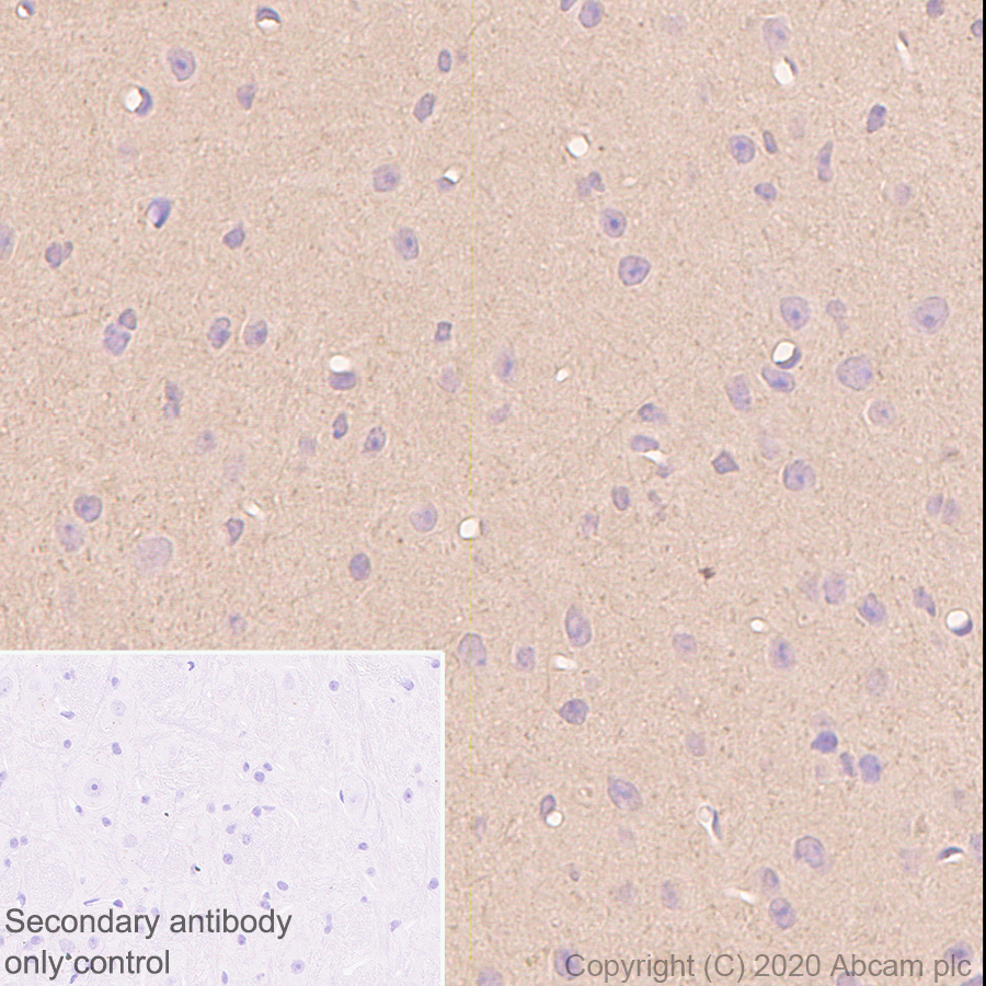 Immunohistochemistry (Formalin/PFA-fixed paraffin-embedded sections) - Anti-Prion protein PrP antibody [EP1802Y] (AB52604), expandable thumbnail