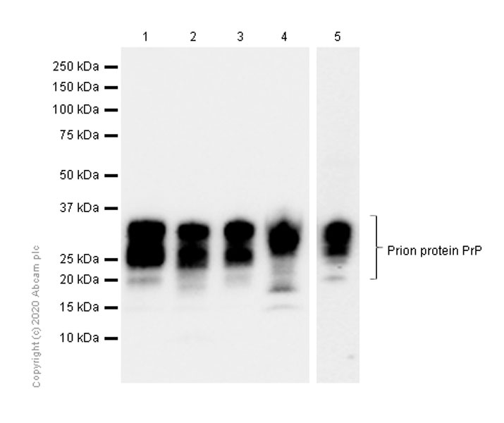 Western blot - Anti-Prion protein PrP antibody [EP1802Y] (AB52604), expandable thumbnail