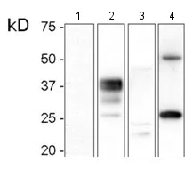 Western blot - Anti-Prion protein PrP antibody [T16-R] (AB136919)