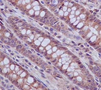 Immunohistochemistry (Formalin/PFA-fixed paraffin-embedded sections) - Anti-PRK3+PRK2+PRK1 (phospho T718 + T774 + T816) antibody [EPR1044(2)] (AB187660)