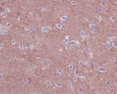 Immunohistochemistry (Formalin/PFA-fixed paraffin-embedded sections) - Anti-PRK3+PRK2+PRK1 (phospho T718 + T774 + T816) antibody [EPR1044(2)] - BSA and Azide free (AB250937)