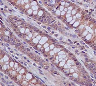 Immunohistochemistry (Formalin/PFA-fixed paraffin-embedded sections) - Anti-PRK3+PRK2+PRK1 (phospho T718 + T774 + T816) antibody [EPR1044(2)] - BSA and Azide free (AB250937)