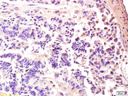 Immunohistochemistry (Formalin/PFA-fixed paraffin-embedded sections) - Anti-PRKAG3 antibody (AB203214)