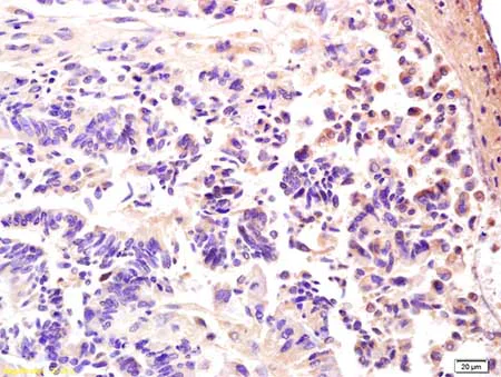 Immunohistochemistry (Formalin/PFA-fixed paraffin-embedded sections) - Anti-PRKAG3 antibody (AB203214)