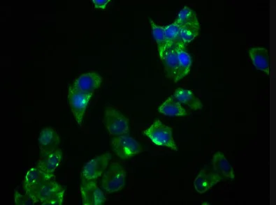 Immunocytochemistry/ Immunofluorescence - Anti-PRKAR1A antibody [1C3] (AB314003)