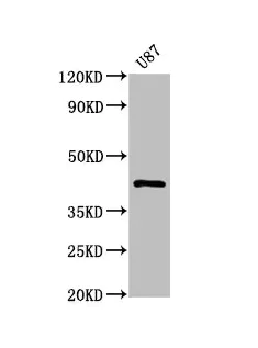 Western blot - Anti-PRKAR1A antibody [1C3] (AB314003)