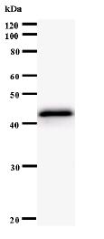 Western blot - Anti-PRKAR1A antibody [3546C2a] (AB60064)
