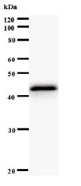 Western blot - Anti-PRKAR1A antibody [3546C2a] (AB60064)