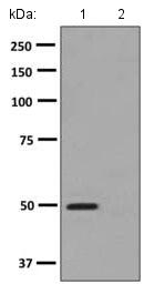 Western blot - Anti-PRKAR1A (phospho S77) antibody [EPMAYR1-127] (AB139682), expandable thumbnail