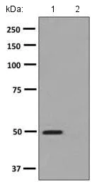 Western blot - Anti-PRKAR1A (phospho S77) antibody [EPMAYR1-127] - BSA and Azide free (AB248879)