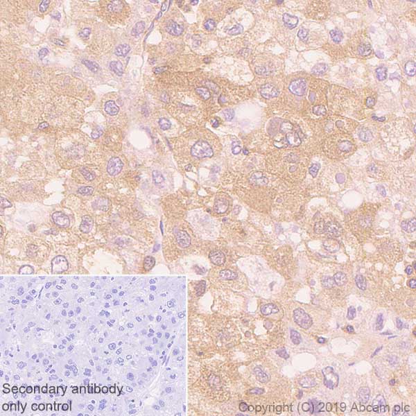 Immunohistochemistry (Formalin/PFA-fixed paraffin-embedded sections) - Anti-PRKAR1A+PRKAR1B antibody [EPR8491] (AB139695)