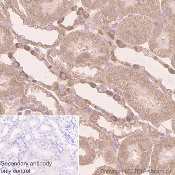 Immunohistochemistry (Formalin/PFA-fixed paraffin-embedded sections) - Anti-PRKAR1A+PRKAR1B antibody [EPR8491] (AB139695)