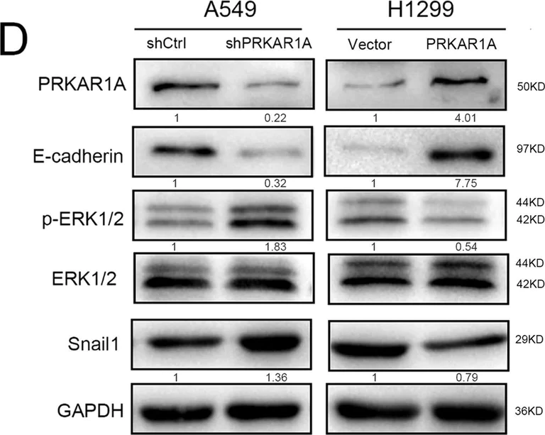 Western blot - Anti-PRKAR1A+PRKAR1B antibody [EPR8491] (AB139695)