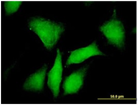 Immunocytochemistry/ Immunofluorescence - Anti-PRKAR1B antibody (AB167325)