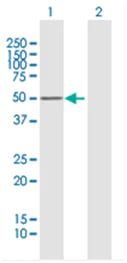 Western blot - Anti-PRKAR1B antibody (AB167325)