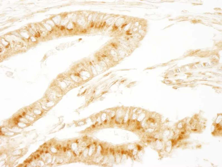 Immunohistochemistry (Formalin/PFA-fixed paraffin-embedded sections) - Anti-PRKAR2 antibody (AB264220)