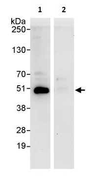 Immunoprecipitation - Anti-PRKAR2 antibody (AB264220), expandable thumbnail