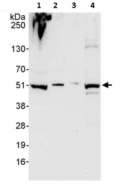 Western blot - Anti-PRKAR2 antibody (AB264220), expandable thumbnail