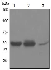 Western blot - Anti-PRKAR2B antibody [EP2648] (AB75996)