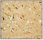 Immunohistochemistry (Formalin/PFA-fixed paraffin-embedded sections) - Anti-PRKAR2B antibody [EP2648] - BSA and Azide free (AB284731)