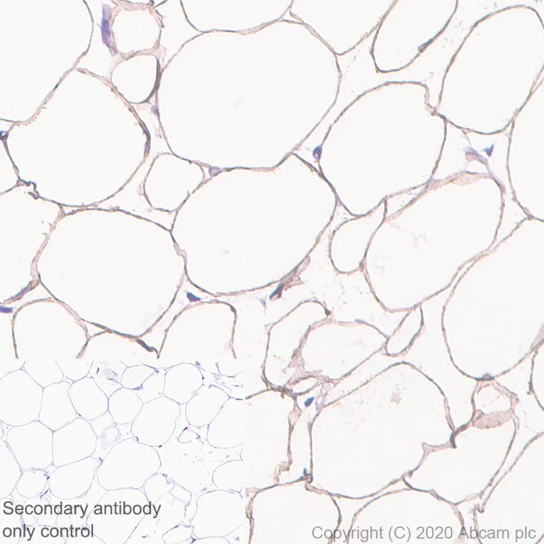 Immunohistochemistry (Formalin/PFA-fixed paraffin-embedded sections) - Anti-PRKAR2B antibody [EP2649Y] (AB75993)