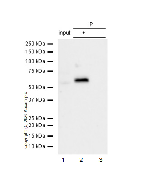 Immunoprecipitation - Anti-PRKAR2B antibody [EP2649Y] (AB75993)