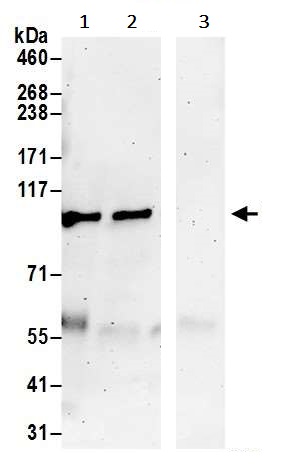 Immunoprecipitation - Anti-PRKD2 antibody (AB245527)