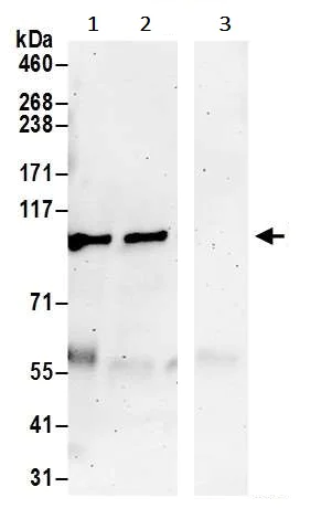 Immunoprecipitation - Anti-PRKD2 antibody (AB245527)
