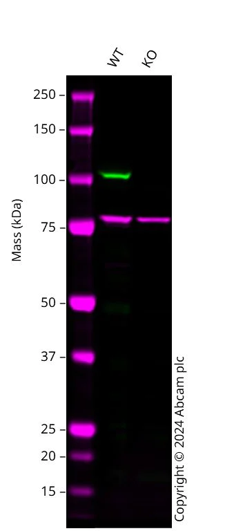 Western blot - Anti-PRKD2 antibody (AB245527)