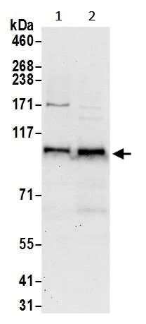 Western blot - Anti-PRKD2 antibody (AB245527)