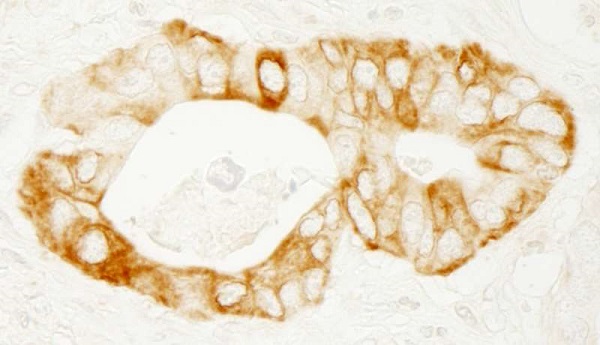 Immunohistochemistry (Formalin/PFA-fixed paraffin-embedded sections) - Anti-PRKD2 antibody (AB245528)