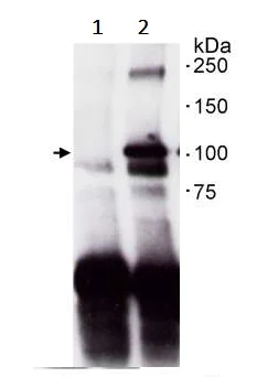 Immunoprecipitation - Anti-PRKD2 antibody (AB245528)