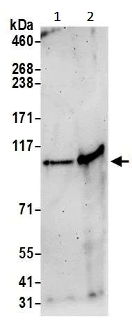 Western blot - Anti-PRKD2 antibody (AB245528)