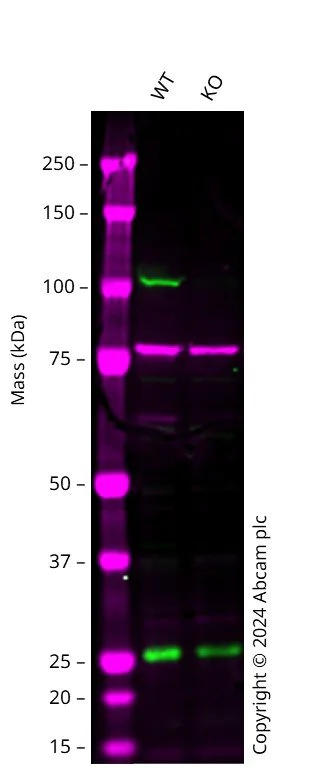 Western blot - Anti-PRKD2 antibody [EP1495Y] (AB51250)