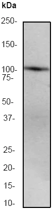 Western blot - Anti-PRKD2 antibody [EP1495Y] (AB51250)
