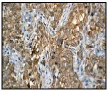 Immunohistochemistry (Formalin/PFA-fixed paraffin-embedded sections) - Anti-PRKD2 antibody [EP1495Y] - BSA and Azide free (AB247314)
