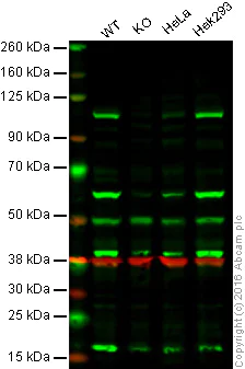 Western blot - Anti-PRKD2 antibody [EP1495Y] - BSA and Azide free (AB247314)