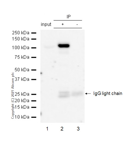 Immunoprecipitation - Anti-PRKD2 (phospho S876) antibody [EP1496Y] (AB51251)